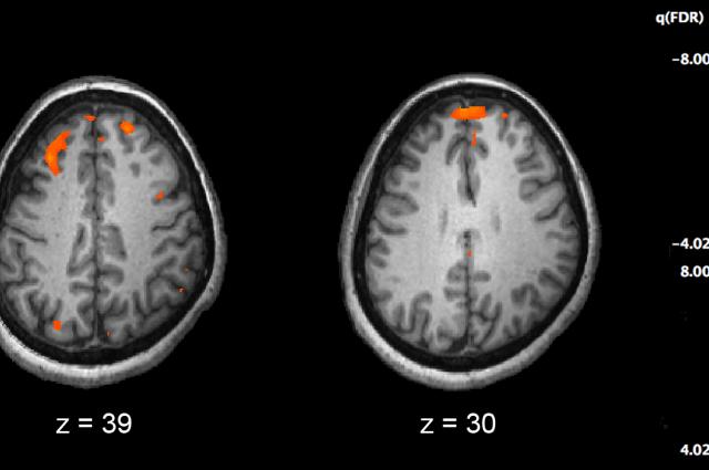 (Credit: PLoS)