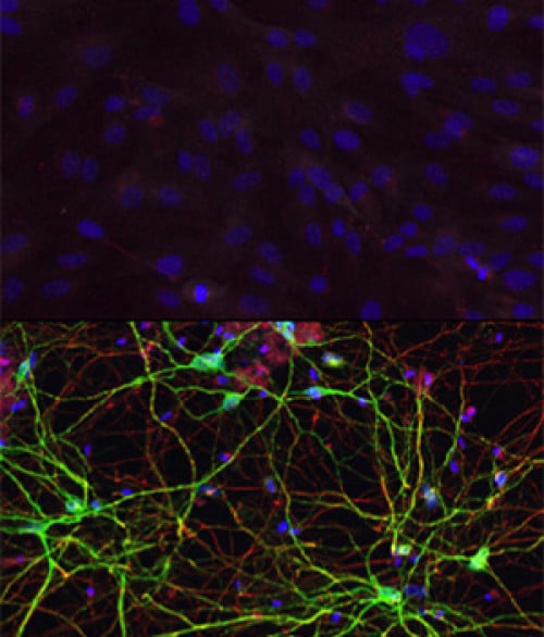 Gornja slika predstavlja stanice kože, koji se nakon izlaganja miRNK i signalnim molekulama (transkripcijskim faktorima) prevode u "medial spiny" neurone, što vidimo na slici ispod. (Credit: Yoo Lab)