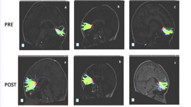 Foto: Radiological Society of North America