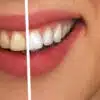 žuti zubi